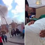 Soldado herido en Viacha cuenta qué ocurrió entre las explosiones: “nos han dicho que vayan a traer agua para apagar el fuego”